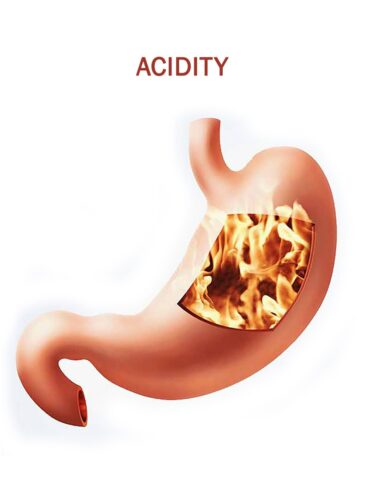 Acidity treatment nagpur