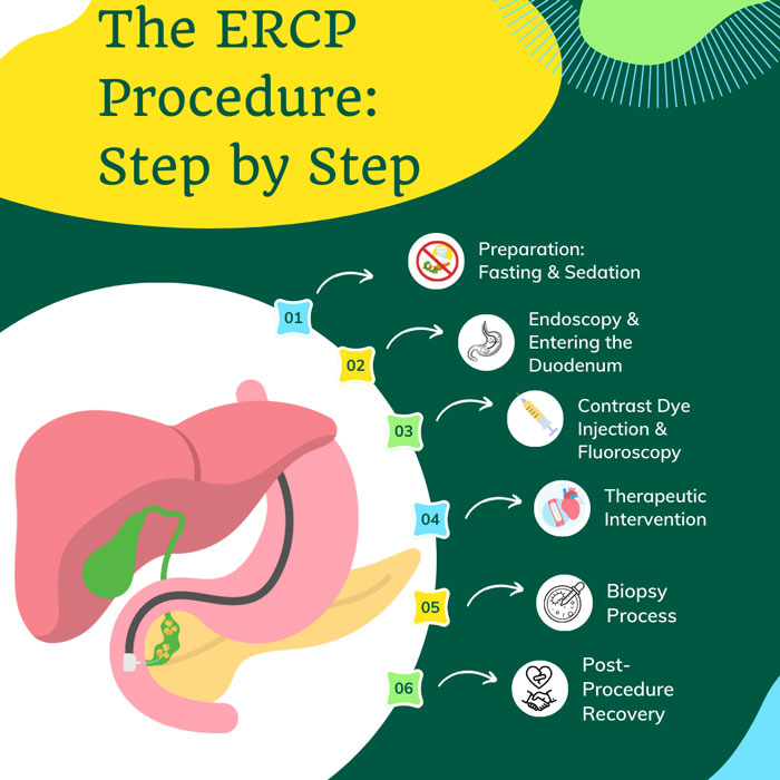 ERCP Procedure nagpur