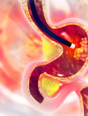 GI Endoscopy specialist nagpur
