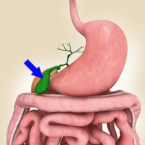 Gallbladder disease doctor in nagpur