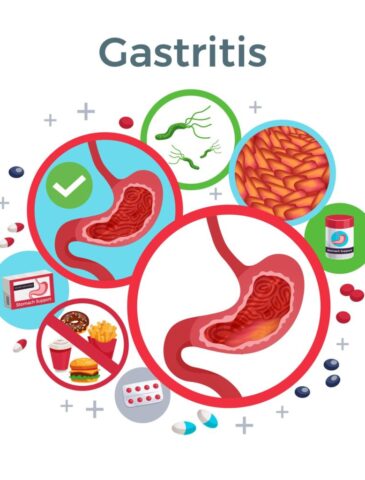 Gastritis treatment nagpur
