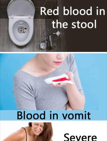 Gastrointestinal bleeding treatment nagpur