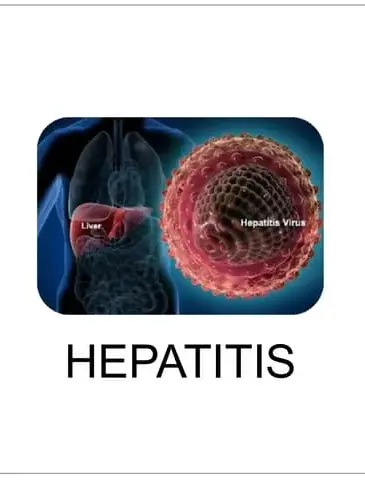 Hepatitis treatment nagpur