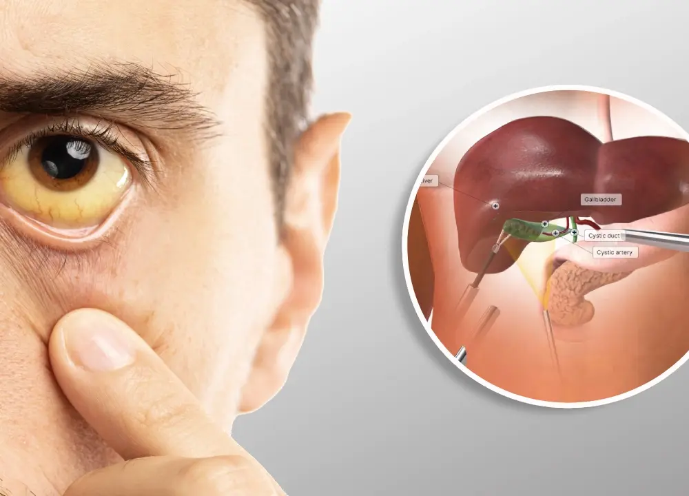 Jaundice treatment doctor nagpur