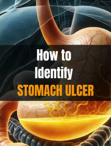 Stomach ulcer doctor in nagpur